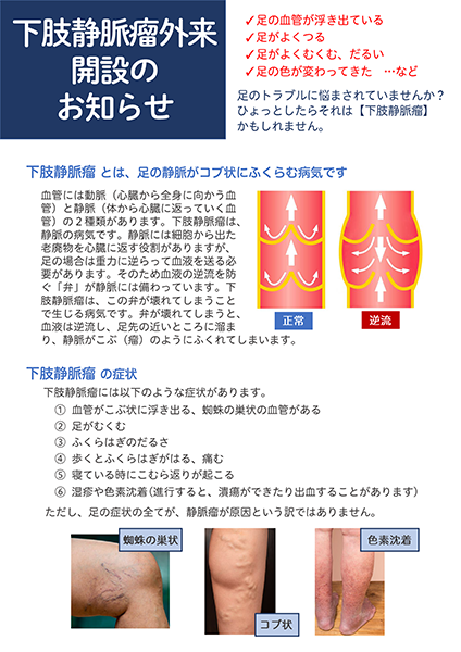 下肢静脈瘤外来開設のお知らせ